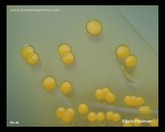 vibrio cholerae on TCBS